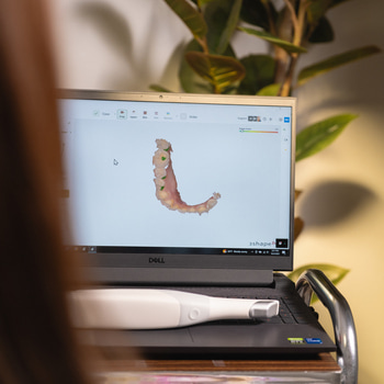 A dental implant model displayed on a laptop screen