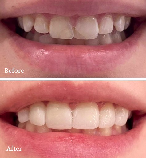 Dental Makeover collage showcase Before and After Procedures