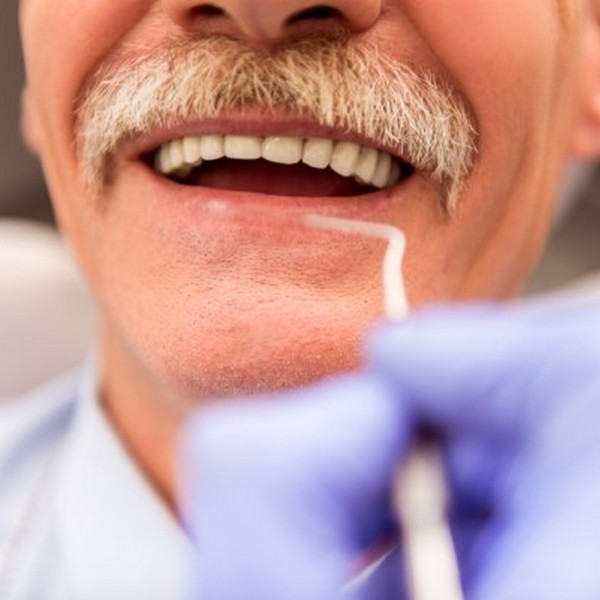 Dentures Offer Numerous Advantages To People Without Teeth
