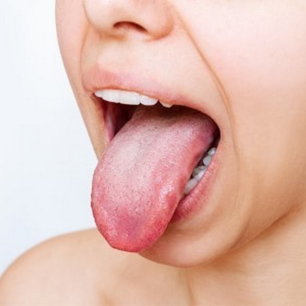 Your Tongue Speaks Volumes About Your Oral Health